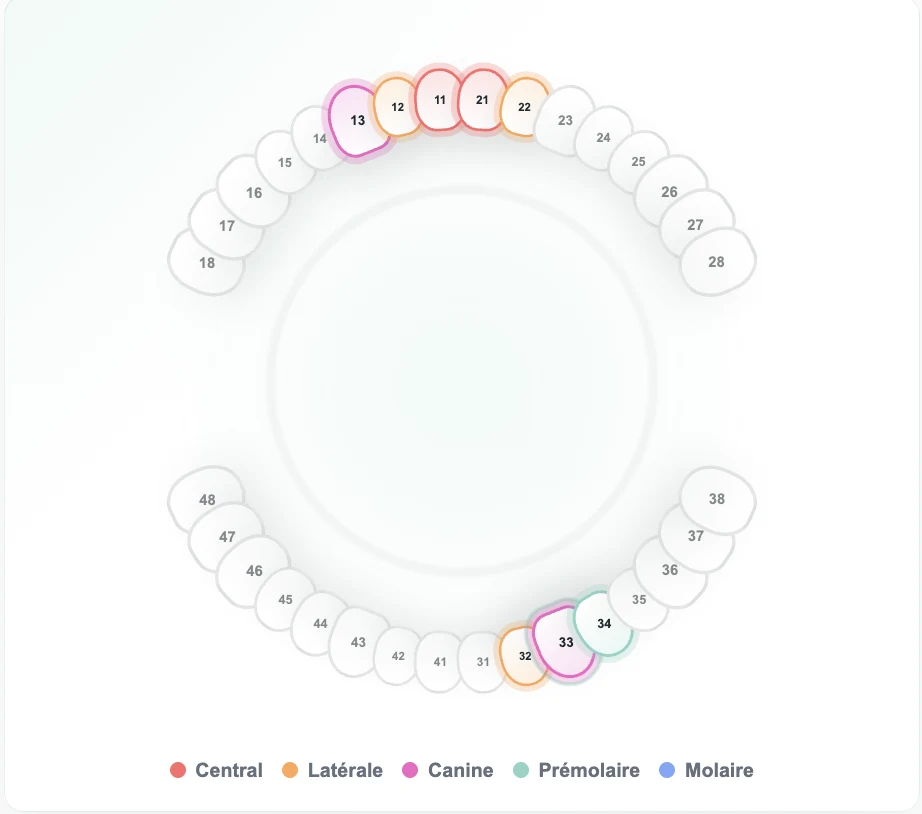 Schéma dentaire interactif avec dents sélectionnées pour un bridge